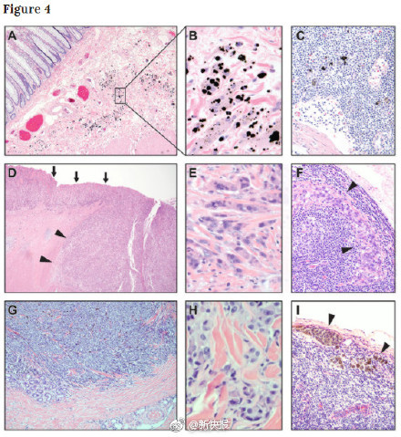 ����ѧ�ҷ�������������     ���ܽ��Ͱ�ϸ����ο���ת��